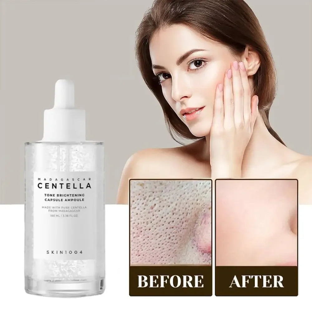 Original Centella Essence Hochwertiges Whitening Brightening Moisturizing Repairing Facia Skin Barrier Angel Skincare 100ml