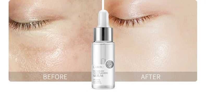 LAIKOU 7-Piece Premium Serum Collection Bundle