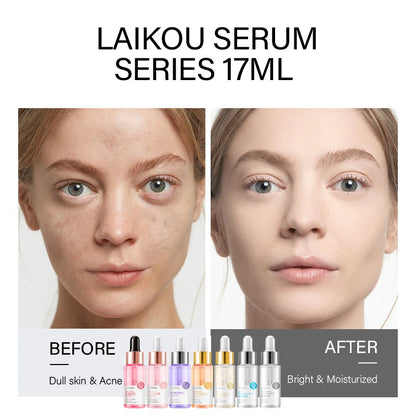 LAIKOU 7-Piece Premium Serum Collection Bundle