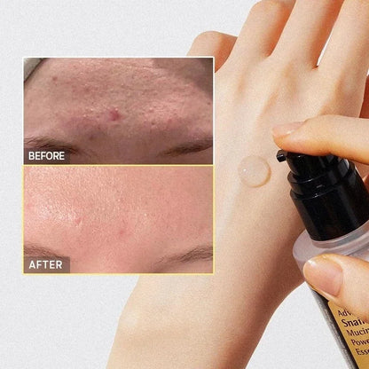 Advanced Snail 96 Mucin Power Essence