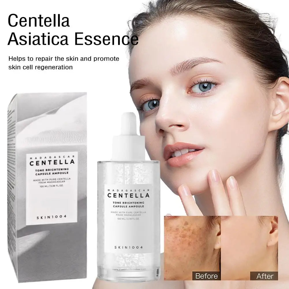 Original Centella Essence Hochwertiges Whitening Brightening Moisturizing Repairing Facia Skin Barrier Angel Skincare 100ml